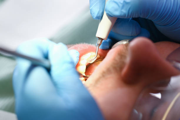 Best Knocked-Out Tooth Emergency  in Nettleton, MS