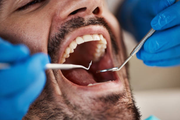 Best Knocked-Out Tooth Emergency  in Nettleton, MS