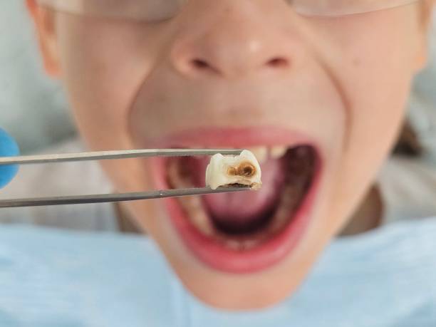 Emergency Dentist for Kids in MS